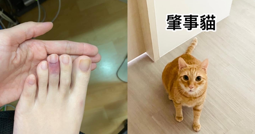 被橘貓撞倒，扭傷腳的主人