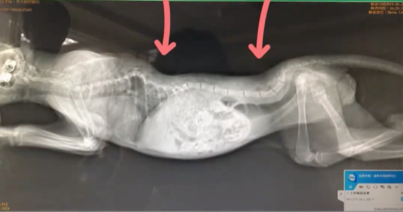 脊椎兩處凹陷。