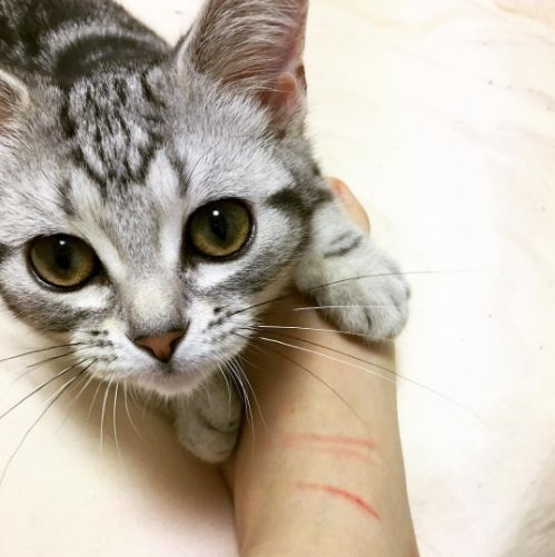 是否需要就醫，取決於傷口的嚴重程度～