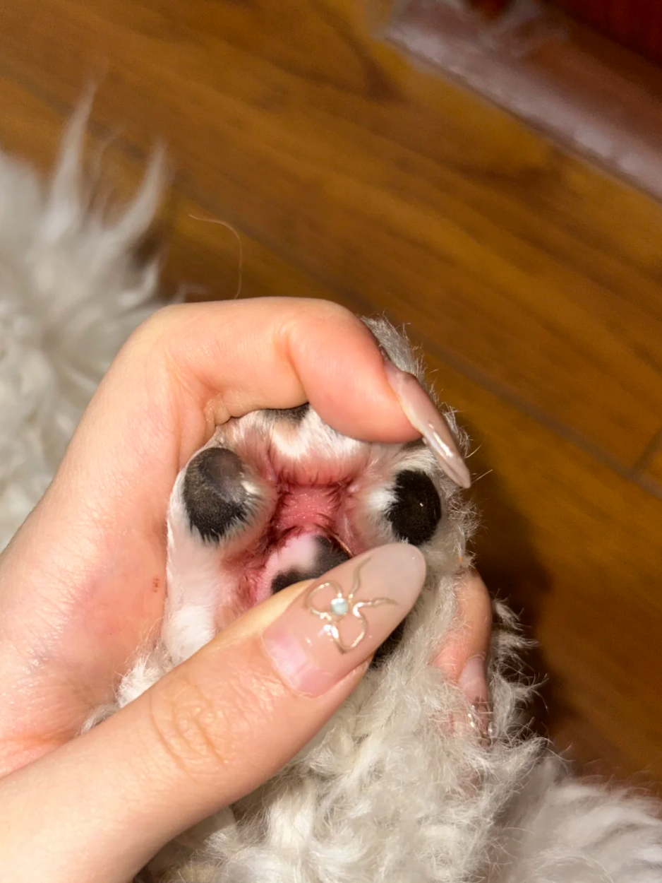 一直舔腳就要小心是趾間炎！