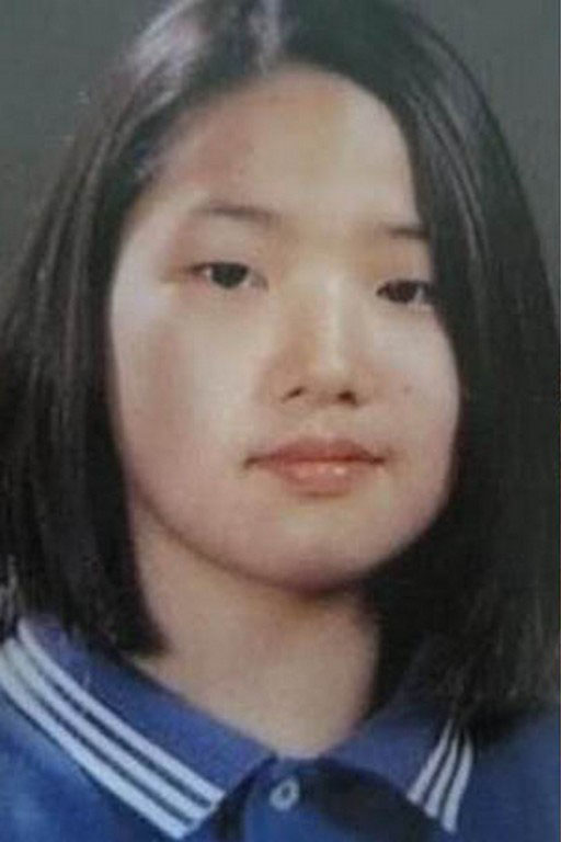 park-min-young-before-plastic-surgery