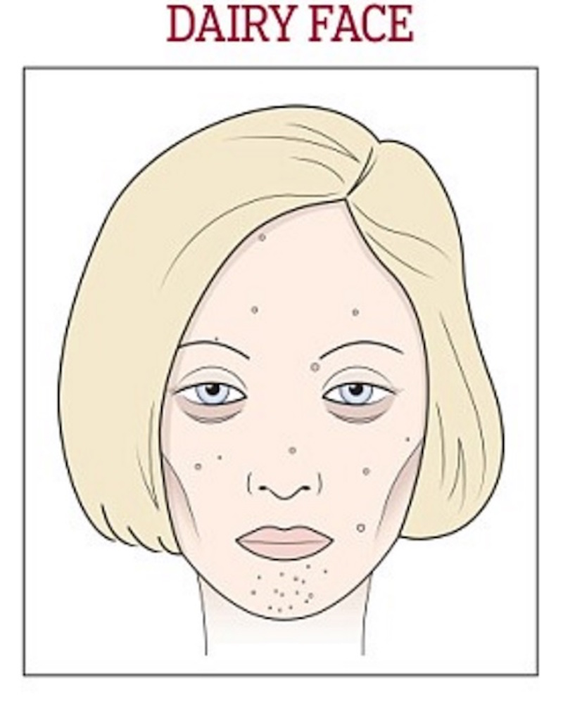dairyface