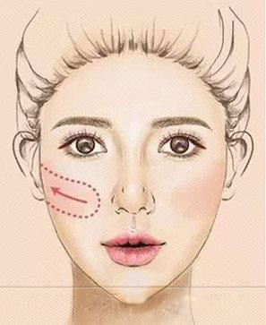 10210003sr5s26oprn0p