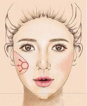 106q000053p3154675qp