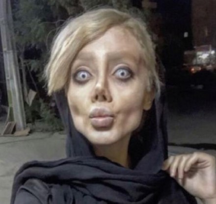【整容失敗】Sahar Tabar為變Angelina Jolie卻整容成癮,19歲女數月整容50次變僵屍新娘