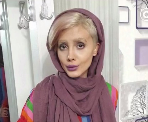 【整容失敗】Sahar Tabar為變Angelina Jolie卻整容成癮,19歲女數月整容50次變僵屍新娘