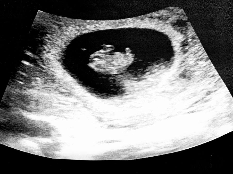 28684839_10156621856982080_1138185994013137021_n