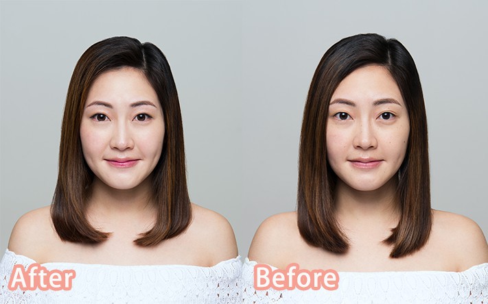 Neutrogena