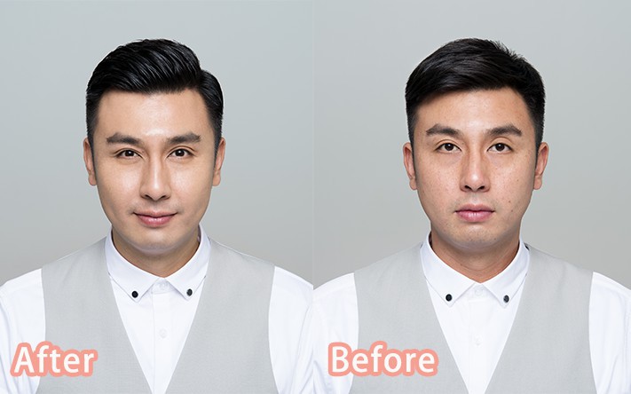 Neutrogena