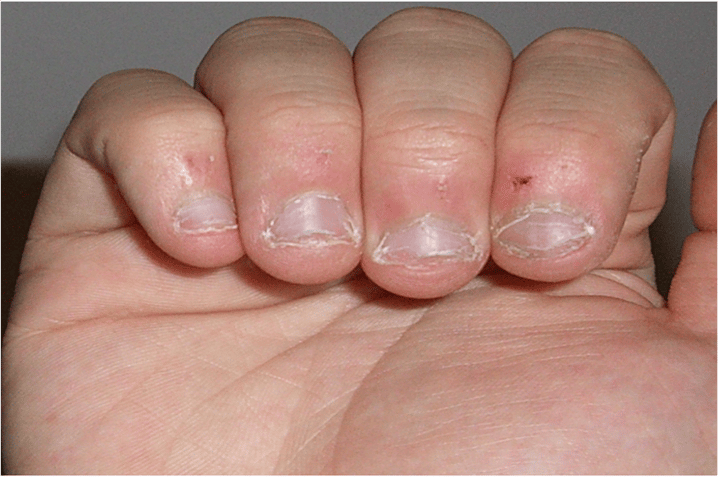 一起把醜指甲變美吧！光療指甲會破壞指甲？ 光療指甲其實可以矯形！ 一起來拆解光療指甲的謬誤！