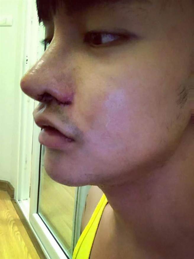 泰國男仔3年做30次整容手術