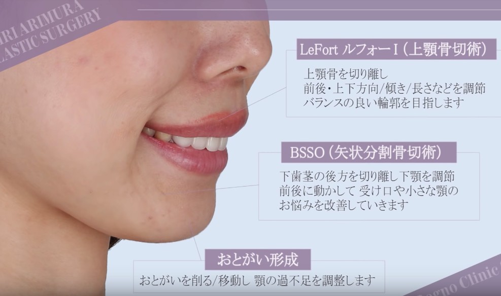 Screen Shot 2019-03-06 at 12.09.53 PM