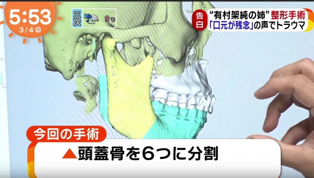 Screen Shot 2019-03-06 at 12.14.22 PM