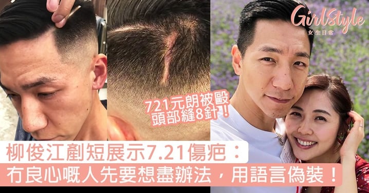 柳俊江7.21受傷縫8針！剷短頭髮展示疤痕：冇良心嘅人先要想盡辦法，用語言偽裝！