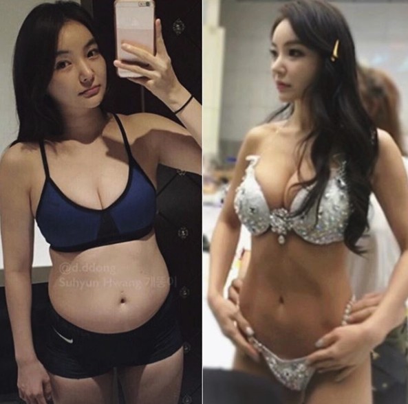 黃秀賢己一開始發胖是因為有甲狀腺功能低下的疾病,為了找回健康的她