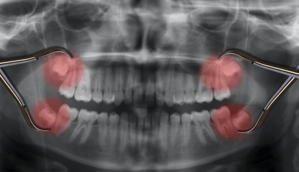 Screen Shot 2019-11-08 at 6.37.08 PM