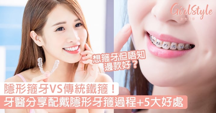 隱形箍牙VS傳統鐵箍！牙醫分享配戴隱形牙箍過程+5大好處！