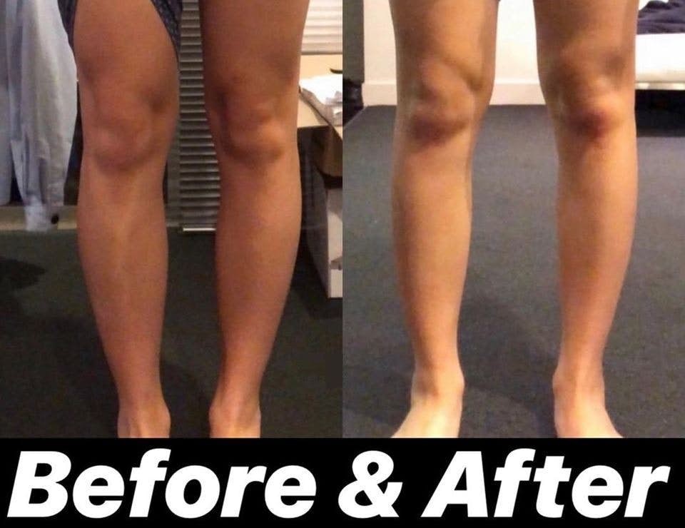 做對的話的話應該會有痛感,代表著結成團的肌肉被伸展開,持之以恆做下去會越來越舒服。