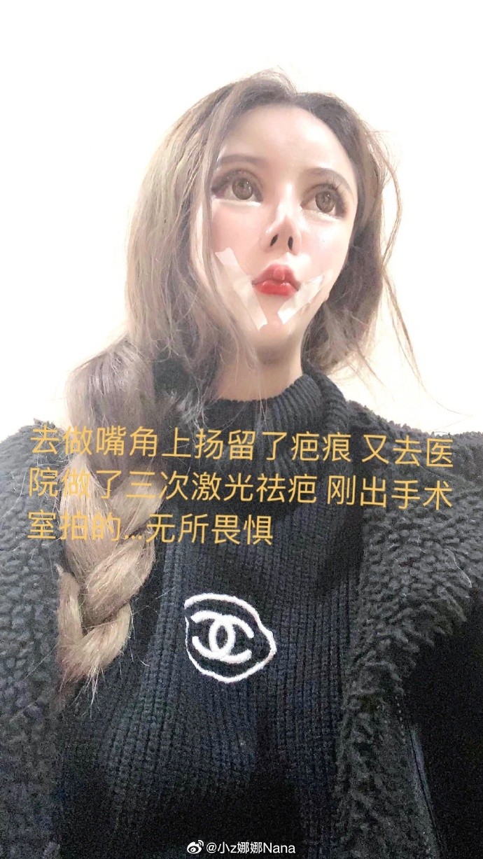 【整容失敗】16歲女3年整容60次!一年換4次身份證:「整容讓我走上人生巔峰」