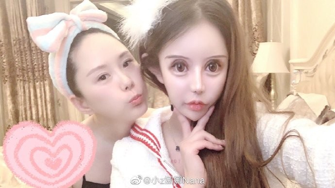 【整容失敗】16歲女3年整容60次!一年換4次身份證:「整容讓我走上人生巔峰」