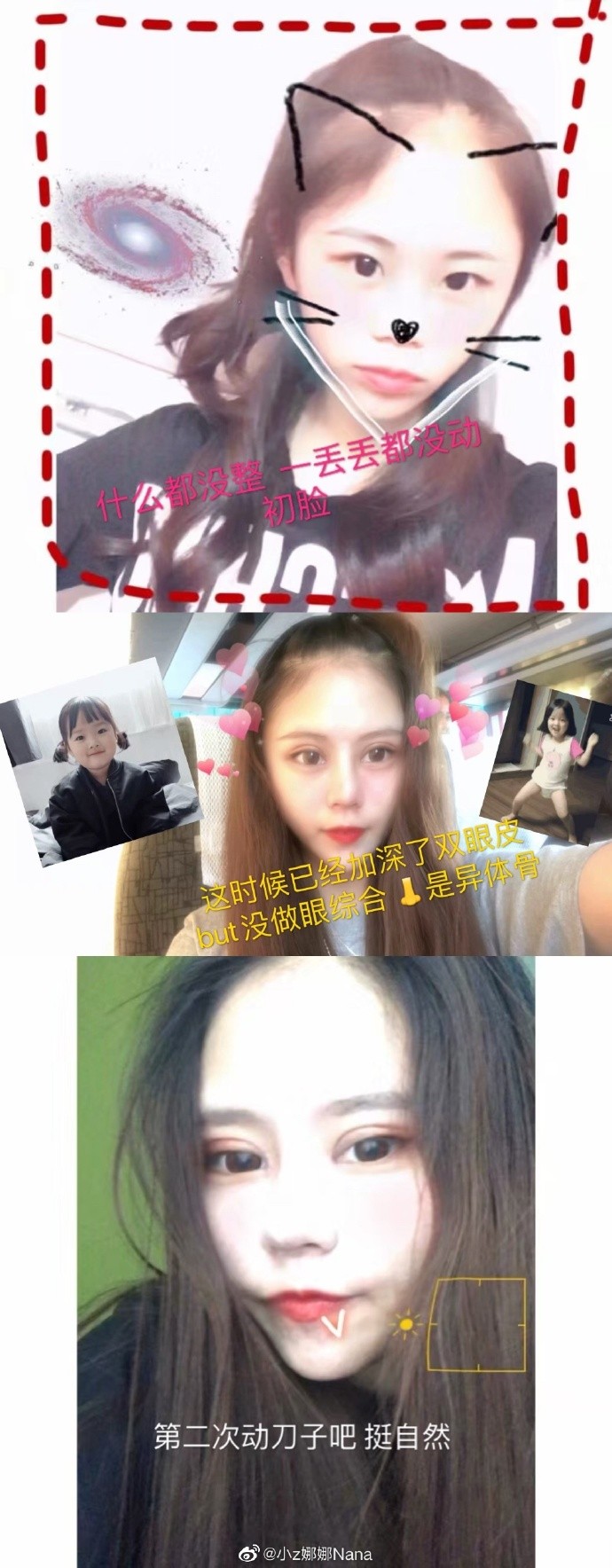【整容失敗】16歲女3年整容60次!一年換4次身份證:「整容讓我走上人生巔峰」