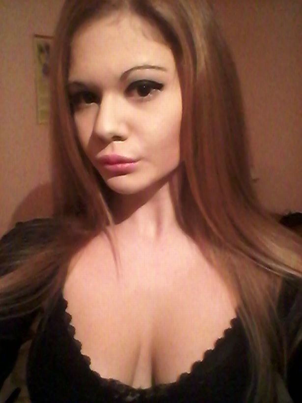 整容世界最厚唇 22歲少女Andrea Ivanova