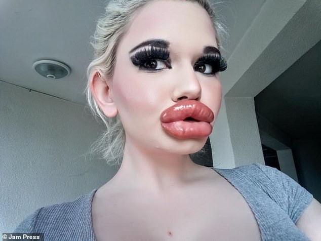 整容世界最厚唇 22歲少女Andrea Ivanova