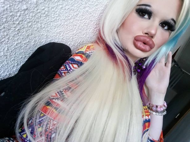 整容世界最厚唇 22歲少女Andrea Ivanova