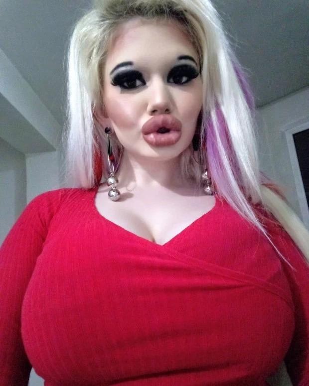 整容世界最厚唇 22歲少女Andrea Ivanova