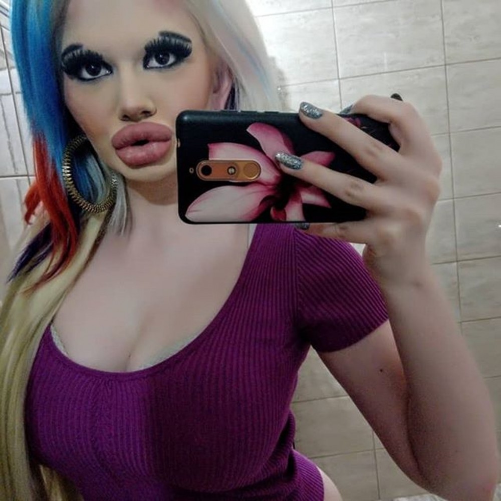 整容世界最厚唇 22歲少女Andrea Ivanova