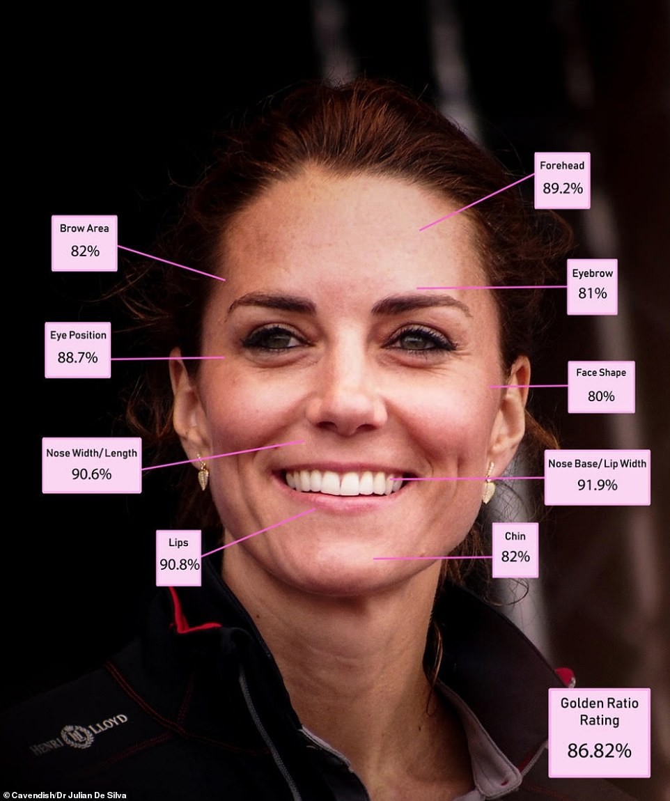 TOP 5: 劍橋公爵夫人凱薩琳 Kate Middleton 86.82%