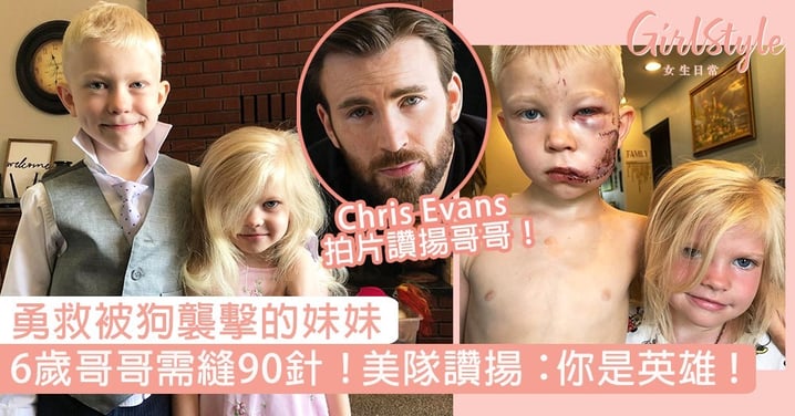 6歲哥哥勇救被狗襲擊妹妹，受傷縫近90針！Chris Evans親自讚揚：你是英雄！
