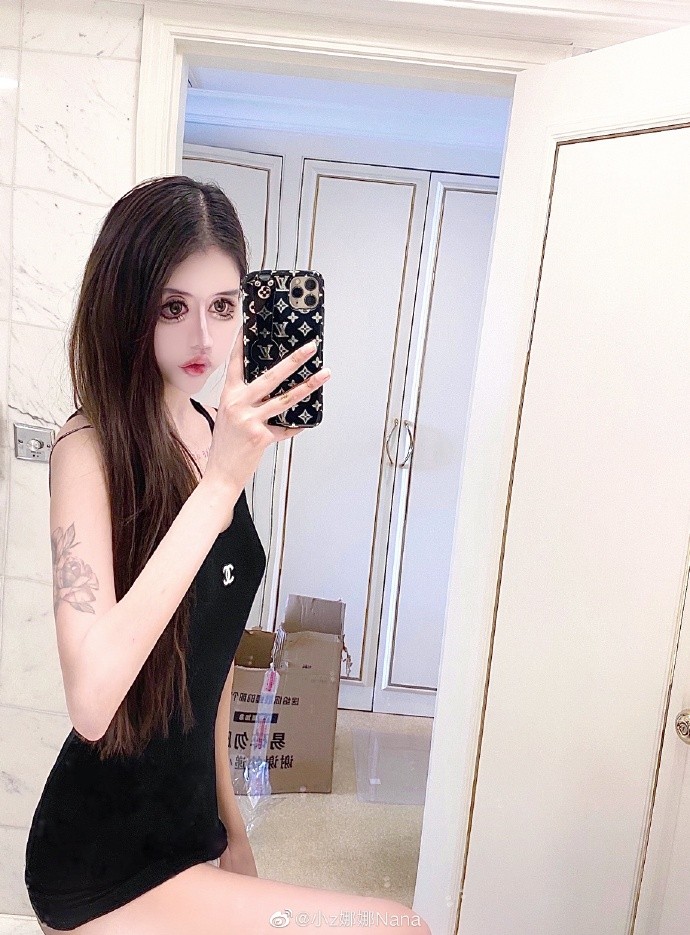 整容上癮, 整容失敗, 整容, 玻尿酸, 大陸網紅, 蛇精女,