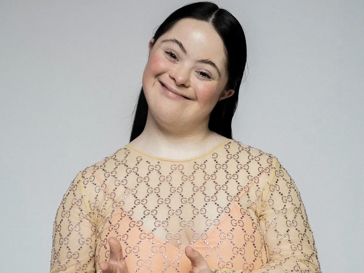 Ellie Goldstein