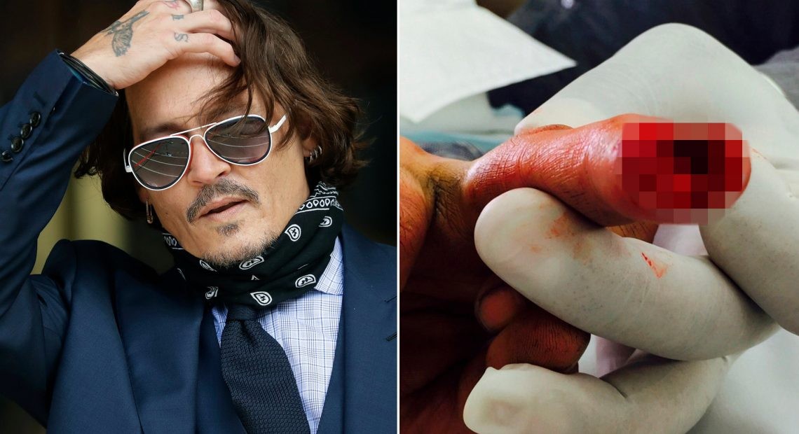Johnny Depp Amber Heard, Johnny Depp Amber Heard官司, Johnny Depp Amber Heard離婚, Amber Heard大便