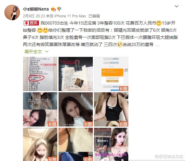 大陸網紅, 整容, 整容上癮, 整容失敗, 玻尿酸, 蛇精女, 內地整容