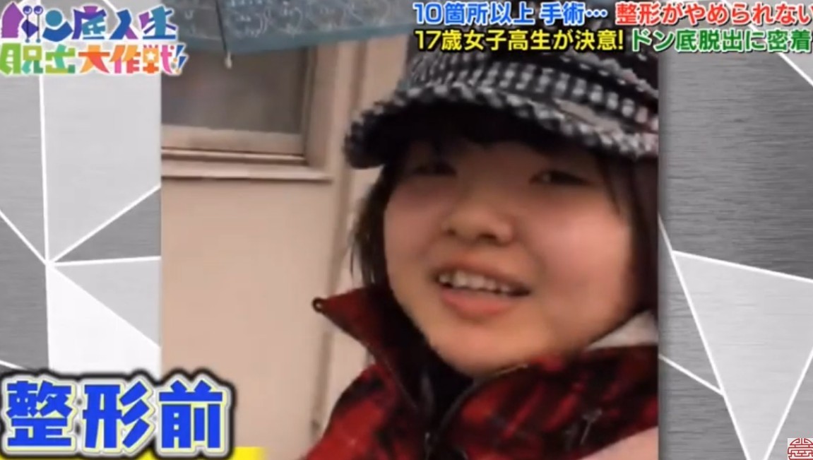 日本女生,整容成癮,整容,整容前後