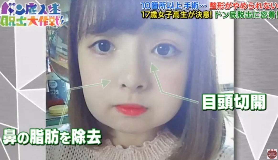 日本女生,整容成癮,整容,整容前後