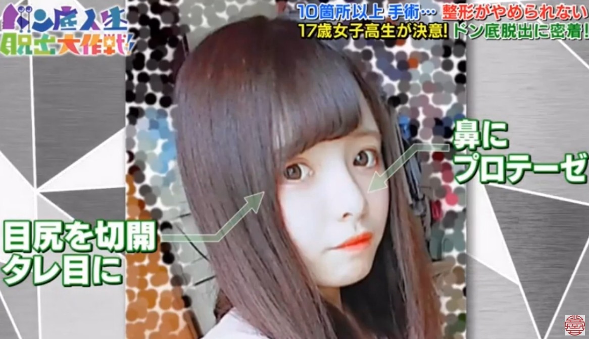 日本女生,整容成癮,整容,整容前後