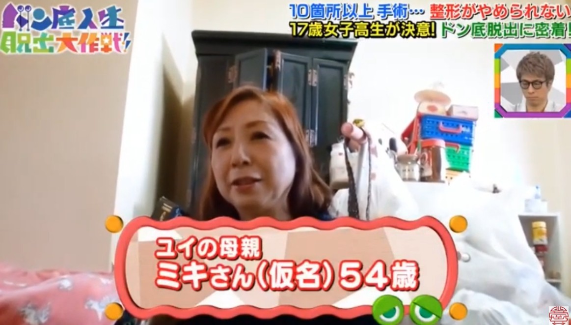 日本女生,整容成癮,整容,整容前後