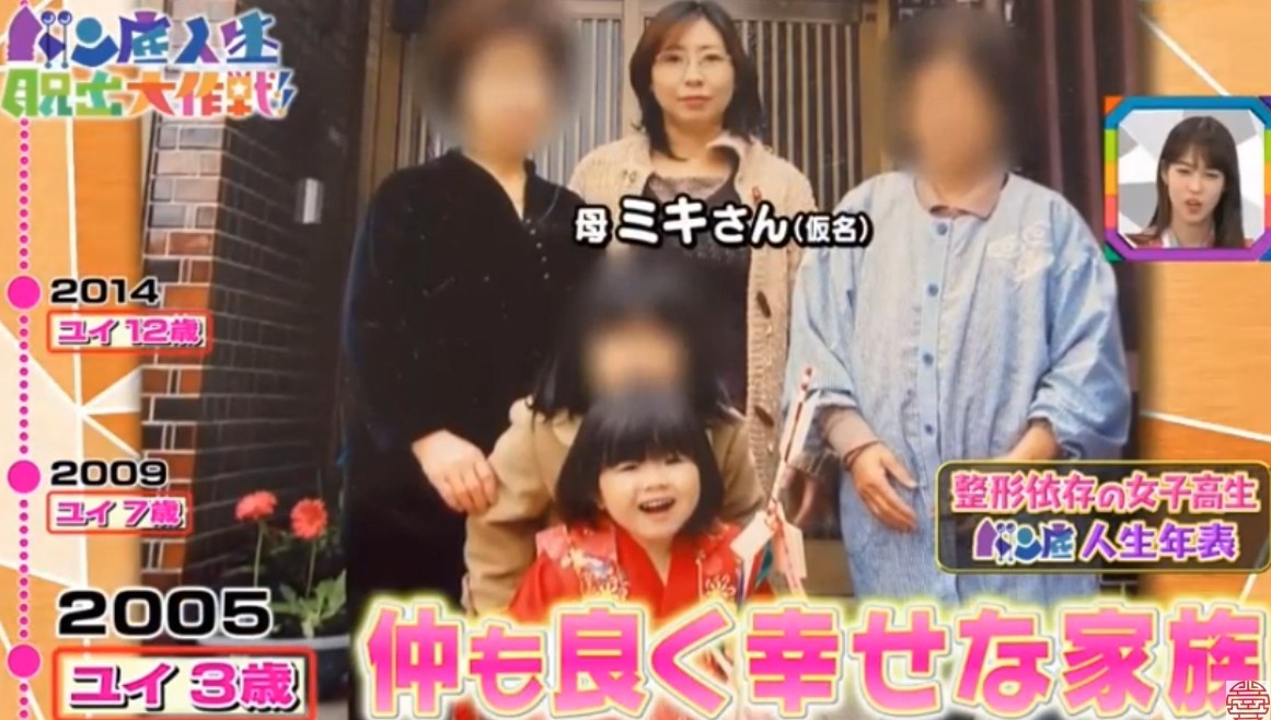 日本女生,整容成癮,整容,整容前後