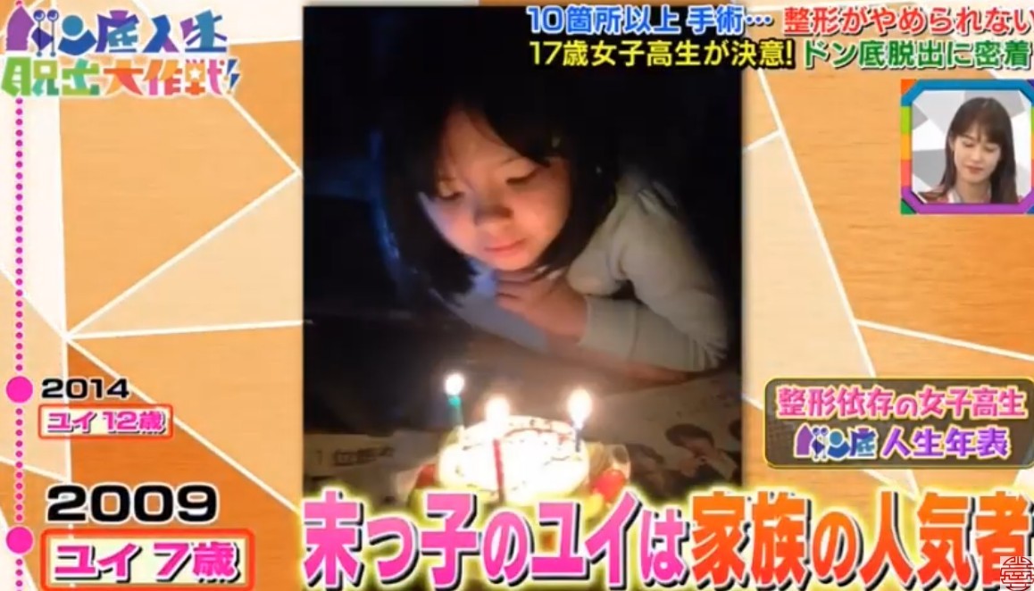 日本女生,整容成癮,整容,整容前後