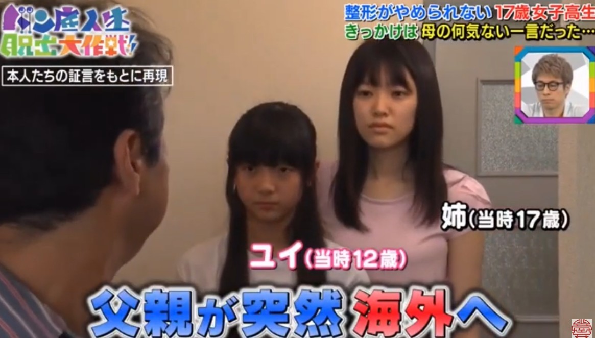日本女生,整容成癮,整容,整容前後