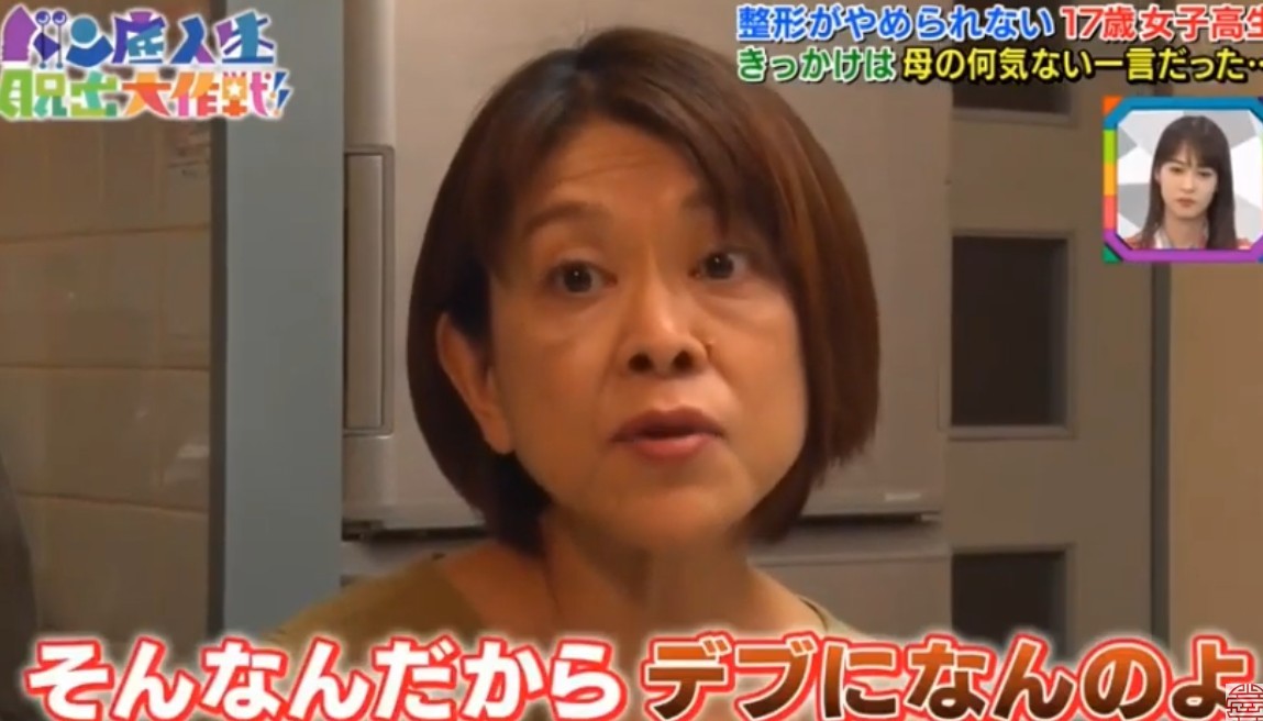 日本女生,整容成癮,整容,整容前後