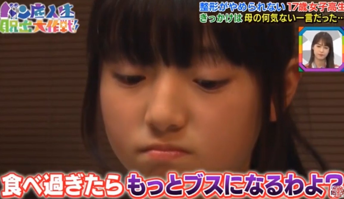 日本女生,整容成癮,整容,整容前後