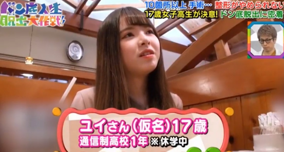 日本女生,整容成癮,整容,整容前後