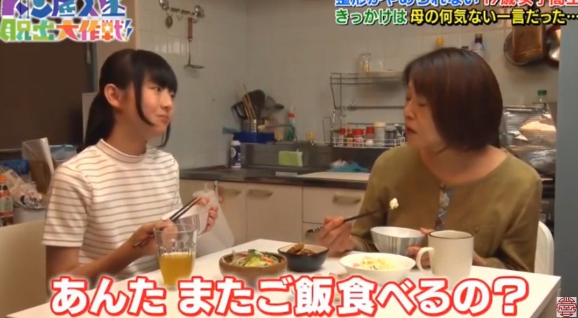 日本女生,整容成癮,整容,整容前後