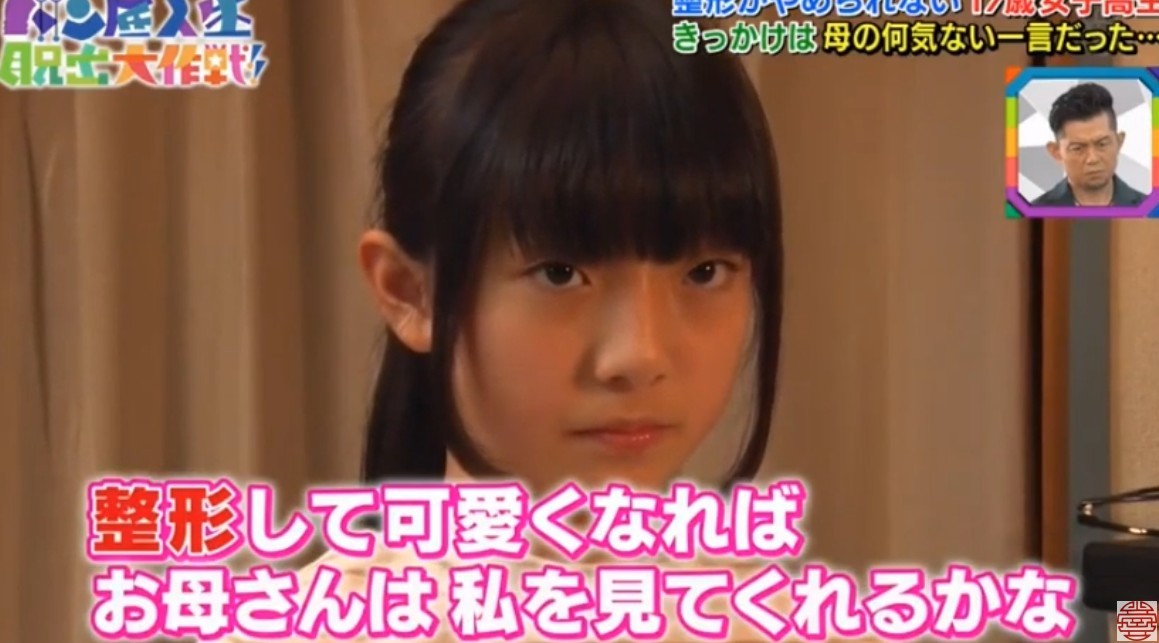 日本女生,整容成癮,整容,整容前後