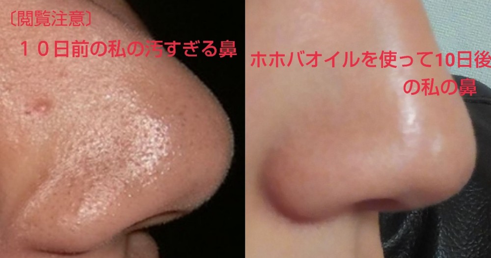 去黑頭, 清黑頭, 無印良品 可可巴油, MUJI 可可巴油, MUJI Jojoba oil