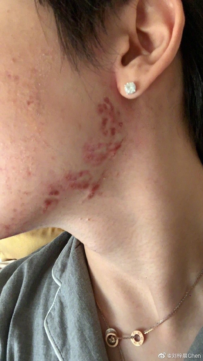 內地「蛇精男」劉梓晨消失3個月自爆全臉毀容!崩潰發文:不知道如何面對我的臉和生活!